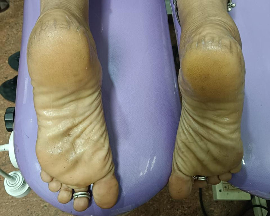 Before Treatment