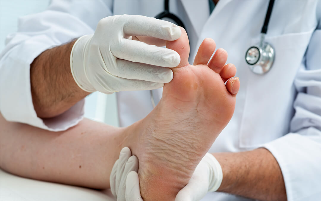 Importance of Diabetic Footwear | Prevent Foot Ulcers with Stepwise